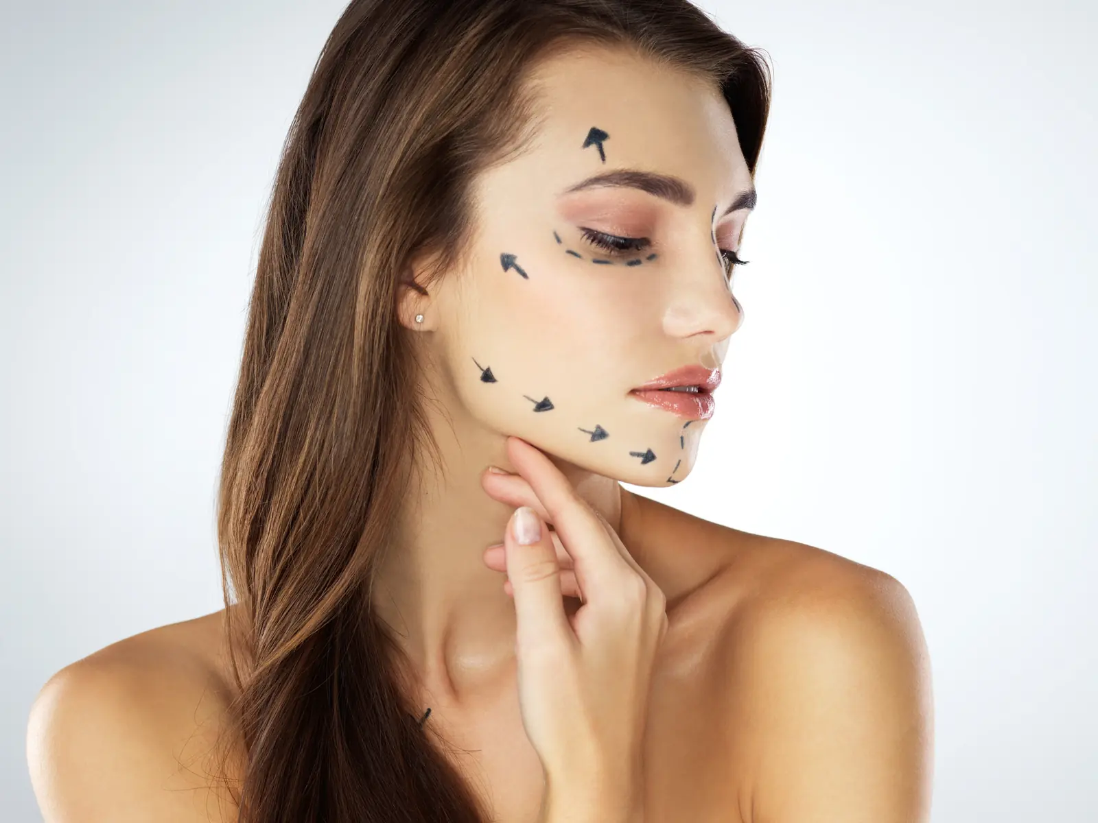 Thread Lift combined with HIFU for full face lifting